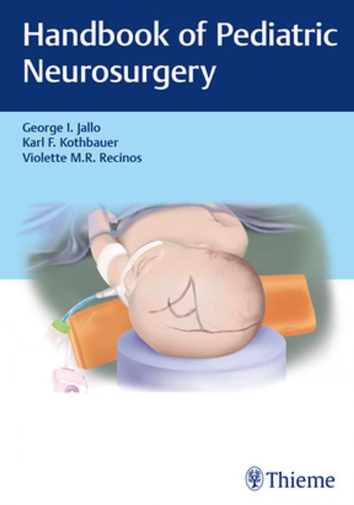 Cover of the book Handbook of Pediatric Neurosurgery by , Thieme
