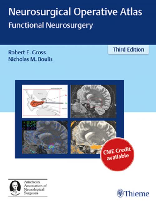 Cover of the book Neurosurgical Operative Atlas: Functional Neurosurgery by , Thieme