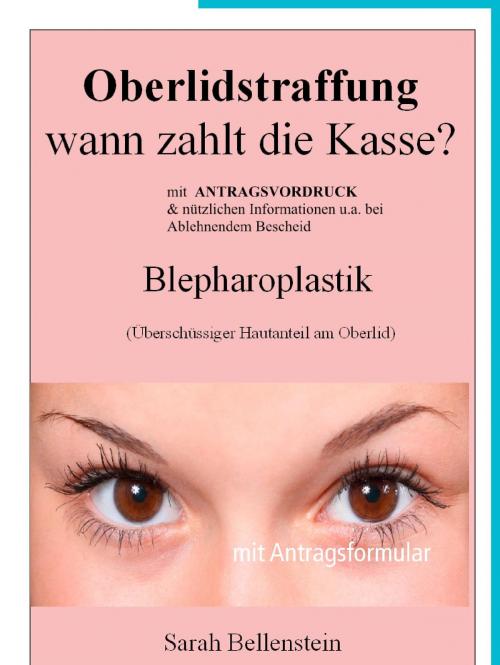 Cover of the book Oberlidstraffung - Wann zahlt die Kasse? by Sarah Bellenstein, Books on Demand