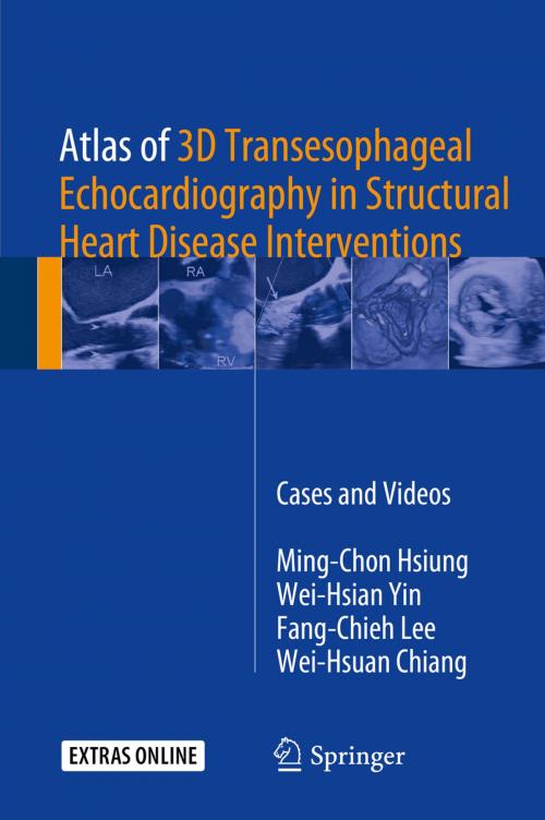 Cover of the book Atlas of 3D Transesophageal Echocardiography in Structural Heart Disease Interventions by Ming-Chon Hsiung, Wei-Hsian Yin, Fang-Chieh Lee, Wei-Hsuan Chiang, Springer Singapore