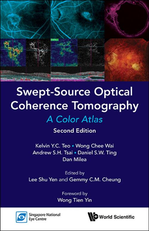 Cover of the book Swept-Source Optical Coherence Tomography by Kelvin Y C Teo, Chee Wai Wong, Andrew S H Tsai;Daniel S W Ting;Dan MileaShu Yen LeeGemmy C M CheungTien Yin Wong, World Scientific Publishing Company