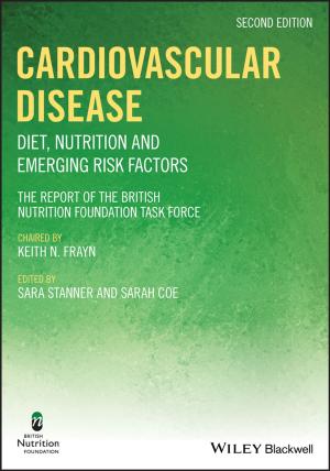 Cover of the book Cardiovascular Disease by Alister E. McGrath