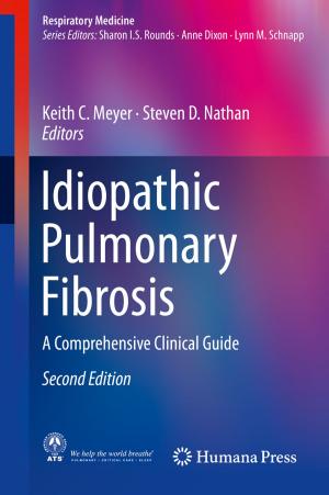 Cover of the book Idiopathic Pulmonary Fibrosis by Nina Fonstein