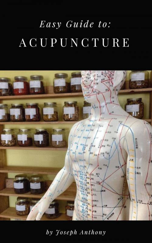 Cover of the book Easy Guide to: Acupuncture by Joseph Anthony, Self Help