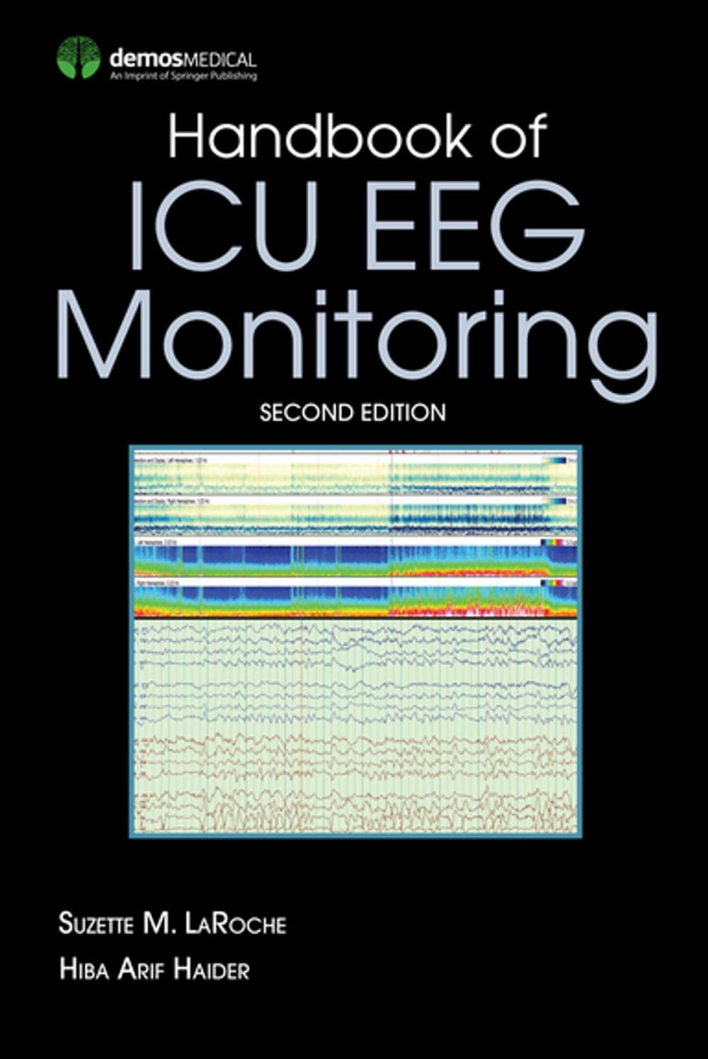 Big bigCover of Handbook of ICU EEG Monitoring