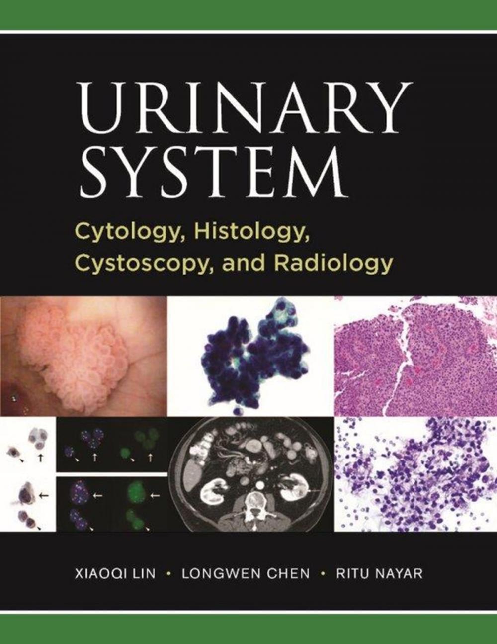 Big bigCover of Urinary System: Cytology, Histology, Cystoscopy, and Radiology
