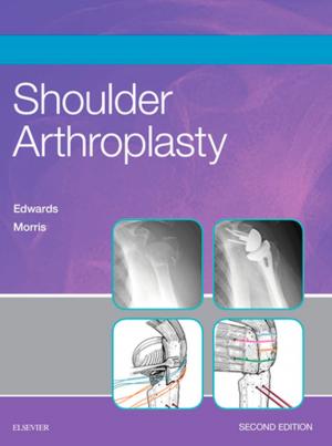 Book cover of Shoulder Arthroplasty E-Book