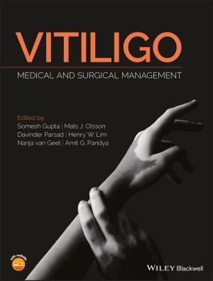 Cover of the book Vitiligo by William N. Zelman, Michael J. McCue, Noah D. Glick, Marci S. Thomas
