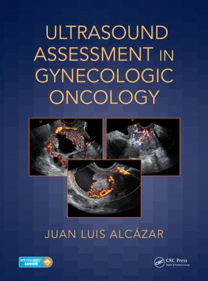 Cover of the book Ultrasound Assessment in Gynecologic Oncology by Frank L. Lewis, Lihua Xie, Dan Popa