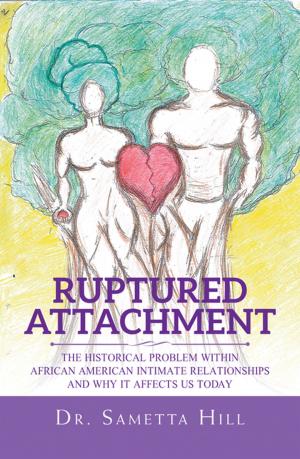 Cover of the book Ruptured Attachment by J. Froebel-Parker