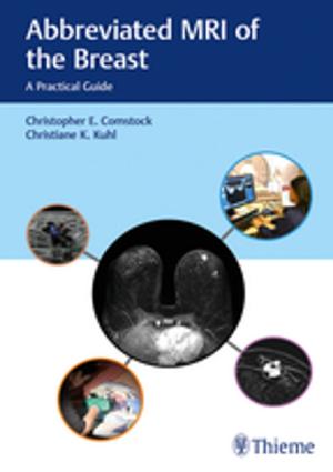 Cover of the book Abbreviated MRI of the Breast by Christopher Herzog, Francis A. Burgener