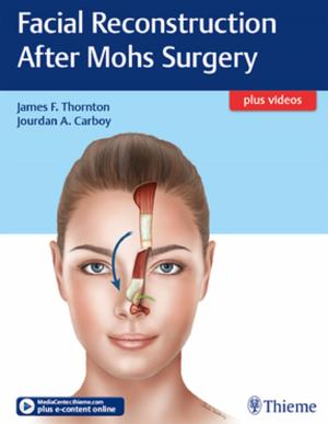 Cover of Facial Reconstruction After Mohs Surgery