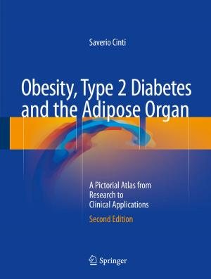 Cover of the book Obesity, Type 2 Diabetes and the Adipose Organ by Stefan Hillmann