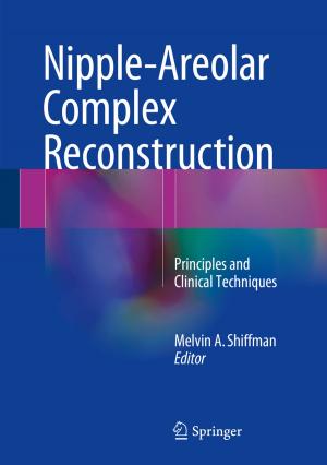 Cover of the book Nipple-Areolar Complex Reconstruction by Ruth Buzi, Debbie Stubbs, Janet Treadwell, Jeanne W. McAllister, Susan Stern, Rebecca Perez