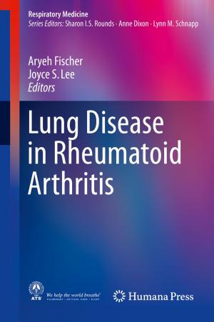 Cover of the book Lung Disease in Rheumatoid Arthritis by Flávio Danni Fuchs