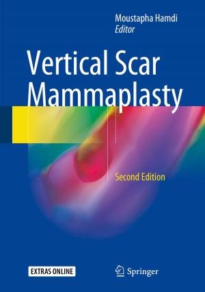 Cover of the book Vertical Scar Mammaplasty by Thomas Stober, Uwe Hansmann