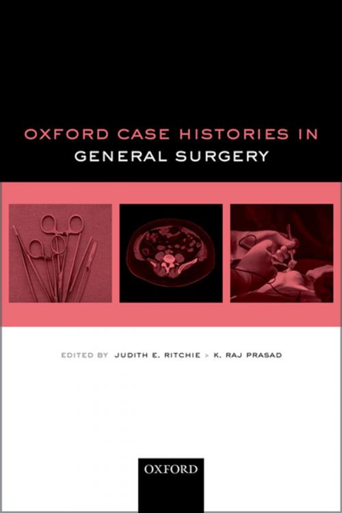 Cover of the book Oxford Case Histories in General Surgery by , OUP Oxford