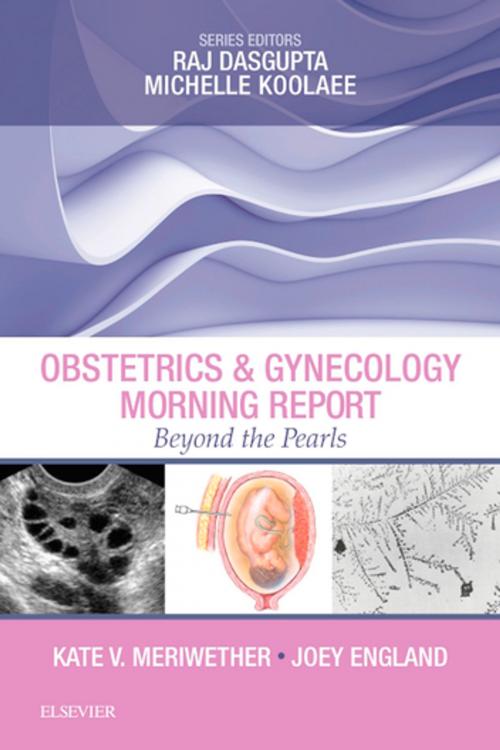 Cover of the book Obstetrics & Gynecology Morning Report: Beyond the Pearls E-Book by Kate V. Meriwether, MD, FACOG, Joey England, MD, Rajkumar Dasgupta, MD, FACP, FCCP, R. Michelle Koolaee, DO, Elsevier Health Sciences