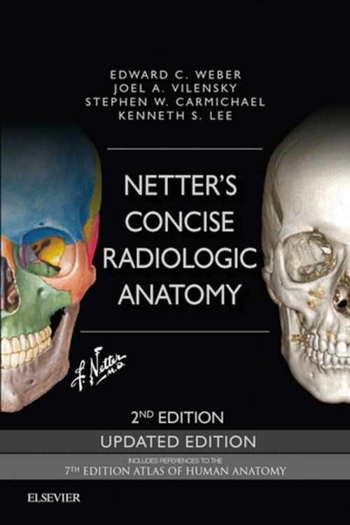 Cover of the book Netter's Concise Radiologic Anatomy Updated Edition E-Book by Edward C. Weber, DO, Joel A. Vilensky, PhD, Stephen W. Carmichael, PhD, DSc, Elsevier Health Sciences