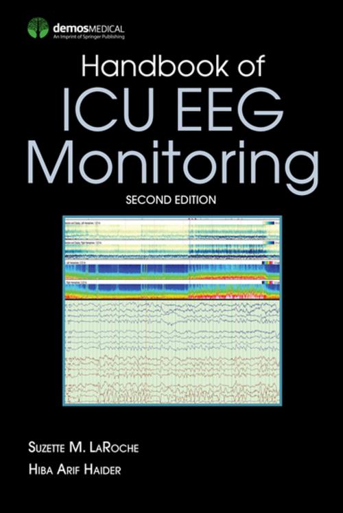 Cover of the book Handbook of ICU EEG Monitoring by , Springer Publishing Company