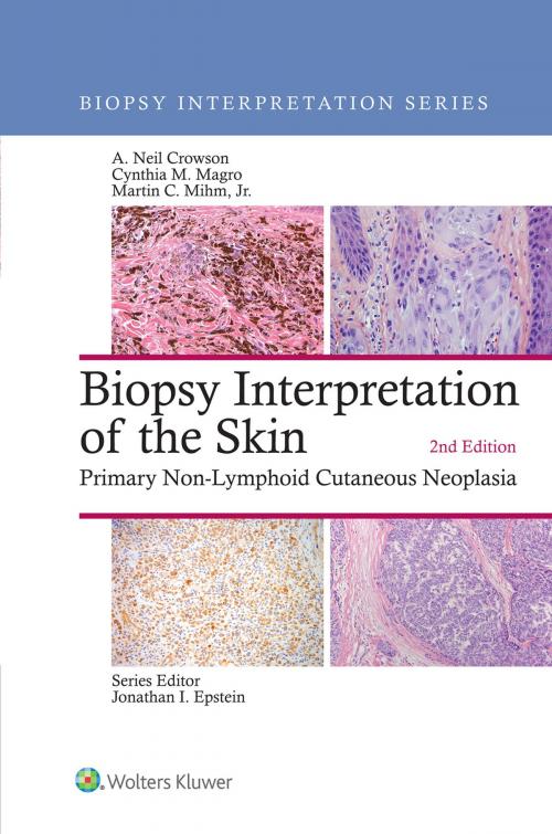 Cover of the book Biopsy Interpretation of the Skin by A. Neil Crowson, Cynthia M. Magro, Wolters Kluwer Health