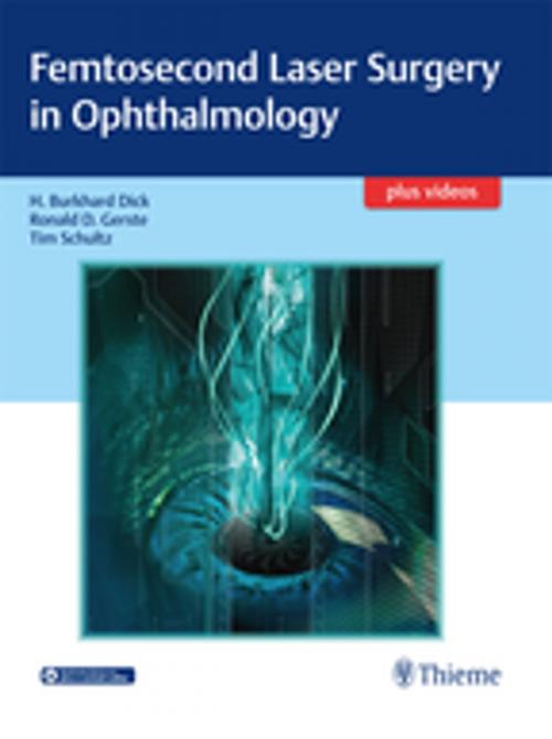 Cover of the book Femtosecond Laser Surgery in Ophthalmology by H. Burkhard Dick, Ronald D. Gerste, Tim Schultz, Thieme