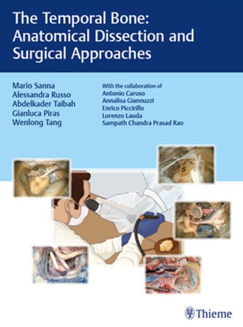 Cover of the book The Temporal Bone by Mario Sanna, Alessandra Russo, Abdelkader Taibah, Thieme