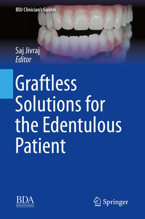 Cover of the book Graftless Solutions for the Edentulous Patient by , Springer International Publishing