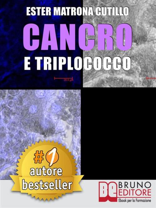 Cover of the book Cancro e Triplococco by ESTER MATRONA CUTILLO, Bruno Editore
