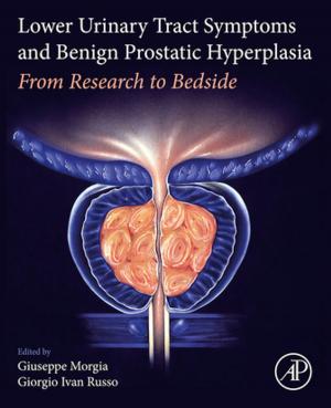 Cover of the book Lower Urinary Tract Symptoms and Benign Prostatic Hyperplasia by Syngress, Dale Liu, Stephanie Miller, Mark Lucas, Abhishek Singh, Jennifer Davis
