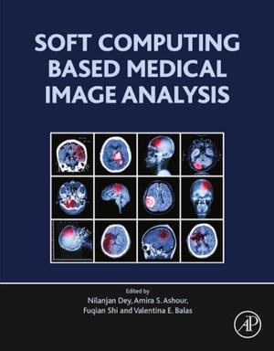 Book cover of Soft Computing Based Medical Image Analysis