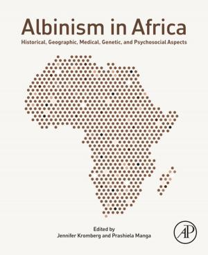 bigCover of the book Albinism in Africa by 