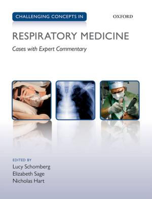 Cover of the book Challenging Concepts in Respiratory Medicine by Eric Heinze