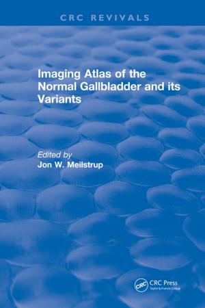 Cover of the book Imaging Atlas of the Normal Gallbladder and Its Variants by Wes Mantooth