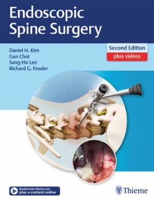 Cover of the book Endoscopic Spine Surgery by Christoph Frank Dietrich, Dieter Nuernberg