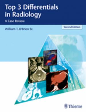 Cover of the book Top 3 Differentials in Radiology by Guillermo Loda