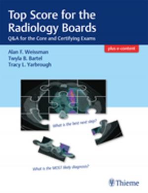 Cover of the book Top Score for the Radiology Boards by Robert F. Spetzler, W. Koos, Johannes Lang