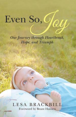Cover of the book Even So, Joy by Lynn Cochrane Leonard