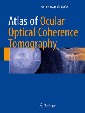 Cover of the book Atlas of Ocular Optical Coherence Tomography by K.V. Raju, A. Ravindra, S. Manasi, K.C. Smitha, Ravindra Srinivas