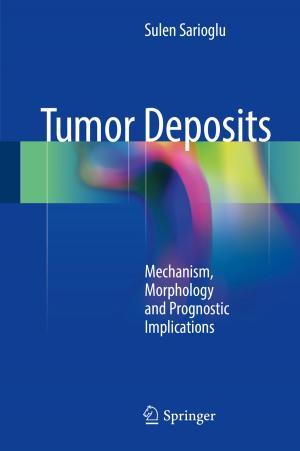 Cover of the book Tumor Deposits by Shlomo Mizrahi
