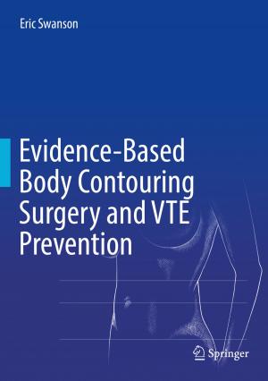 Cover of the book Evidence-Based Body Contouring Surgery and VTE Prevention by Joe Briscoe, Steve Dunn