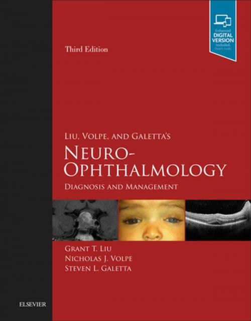 Cover of the book Liu, Volpe, and Galetta’s Neuro-Ophthalmology E-Book by Grant T. Liu, MD, Nicholas J. Volpe, MD, Steven L. Galetta, MD, Elsevier Health Sciences