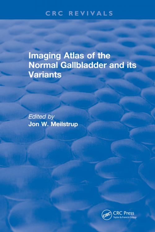 Cover of the book Imaging Atlas of the Normal Gallbladder and Its Variants by J.W. Meilstrup, Taylor and Francis