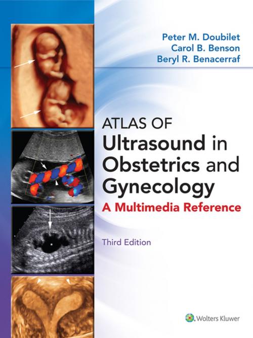 Cover of the book Atlas of Ultrasound in Obstetrics and Gynecology by Peter M. Doubilet, Carol B. Benson, Beryl R. Benacerraf, Wolters Kluwer Health