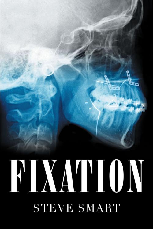Cover of the book Fixation by Steve Smart, Page Publishing, Inc.