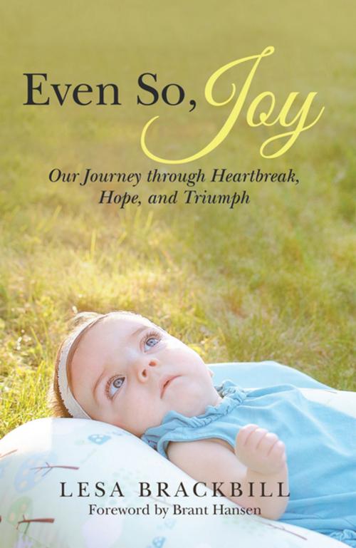 Cover of the book Even So, Joy by Lesa Brackbill, WestBow Press