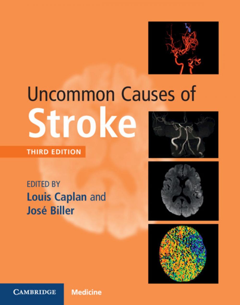 Big bigCover of Uncommon Causes of Stroke