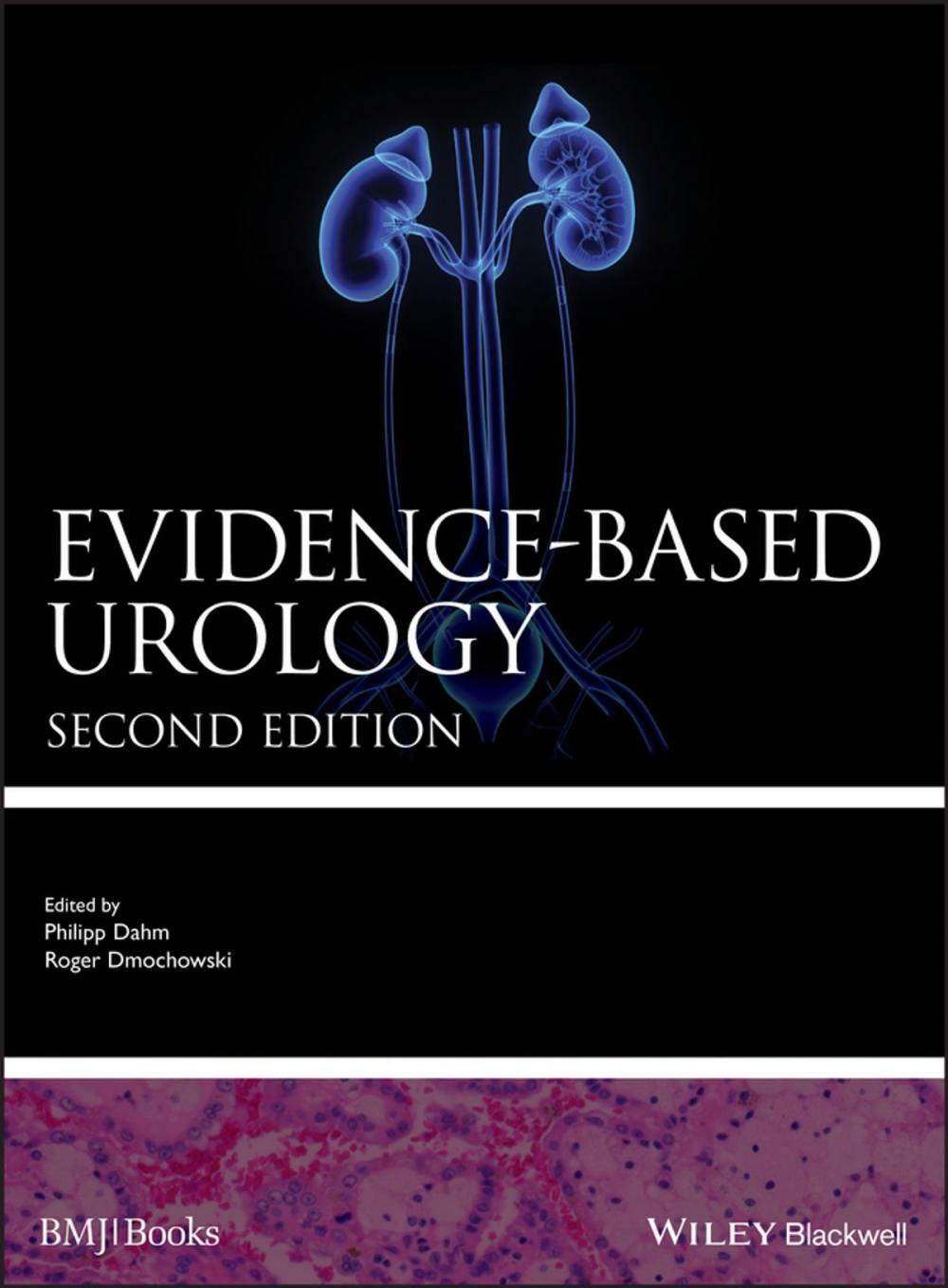 Big bigCover of Evidence-based Urology