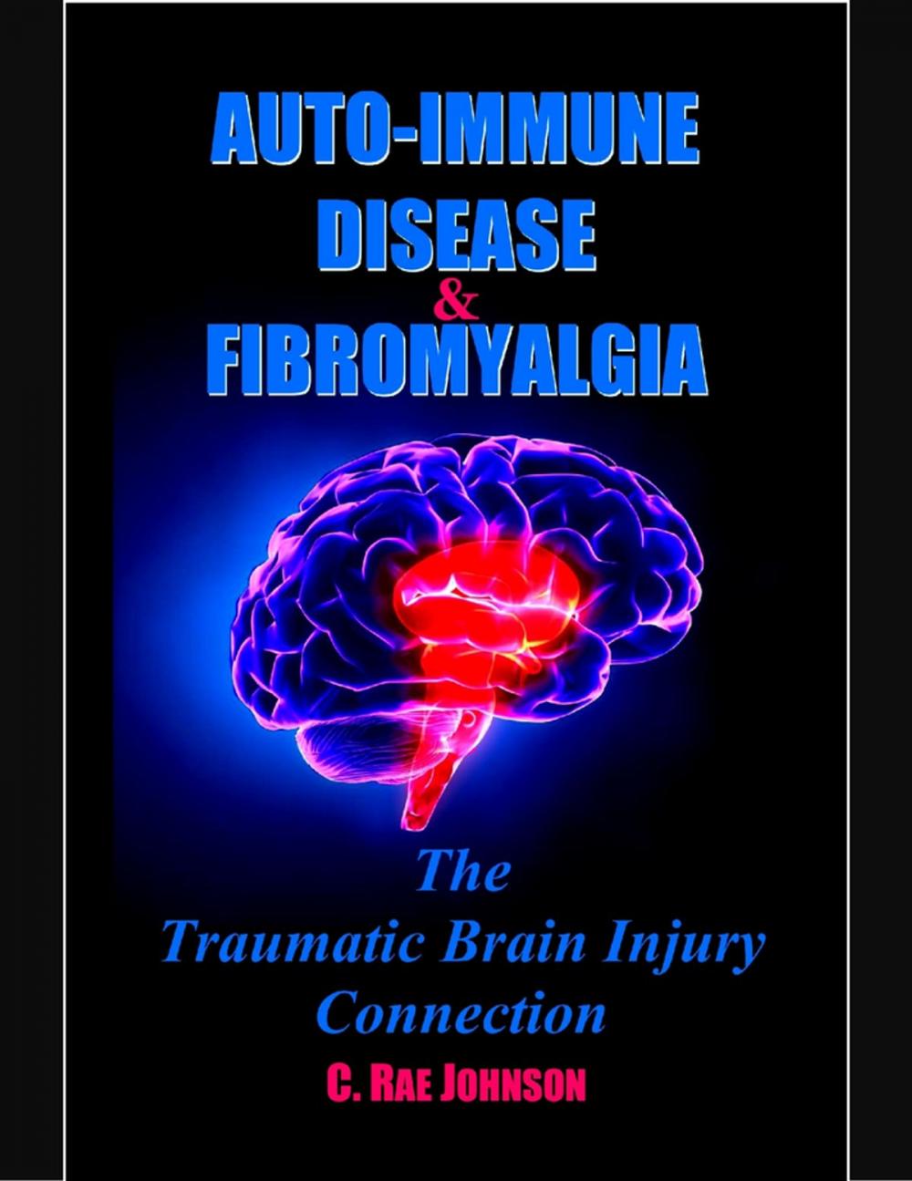 Big bigCover of Auto Immune Disease and Fibromyalgia: The Traumatic Brain Injury Connection