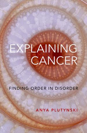 Cover of the book Explaining Cancer by Goodwin Liu, Pamela S. Karlan, Christopher H. Schroeder